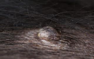 Dog with multiple shaved areas showing skin lumps for veterinary examination.