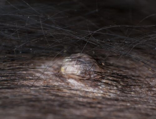 Lumps and Bumps: When Is a Mass an Emergency?